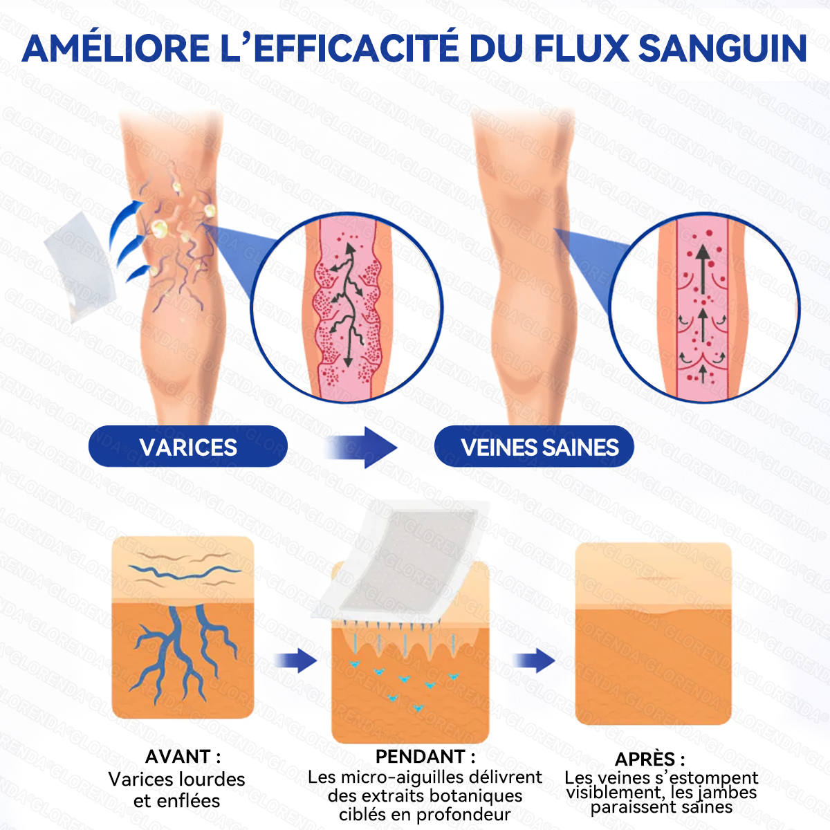 𝐆𝑳𝑶𝗥𝙀𝙉𝐃𝑨®𝐏𝐚𝒕𝒄𝗵 𝗠𝙞𝙘𝙧𝙤𝙣𝙚𝐞𝐝𝐥𝒆 𝑪𝒐𝒏𝘁𝗼𝙪𝙧 𝙙𝐞𝐬 𝐕𝐞𝒊𝒏𝒆𝘀 𝗮𝘃𝙚𝙘 𝙇𝙞𝙫𝐫𝐚𝐢𝐬𝒐𝒏 𝑨𝒗𝒂𝗻𝗰é𝙚 𝙙𝙚 𝘿𝙞𝐨𝐬𝐦𝐢𝒏𝒆 & 𝑯𝗲𝘀𝗽é𝗿𝙞𝙙𝙞𝙣𝙚💃 𝐑é𝐬𝐮𝐥𝐭𝐚𝐭𝐬 𝐕𝐢𝐬𝐢𝐛𝐥𝐞𝐬 𝐞𝐧 𝟕 𝐉𝐨𝐮𝐫𝐬 — 𝐌é𝐥𝐚𝐧𝐠𝐞 𝐇𝐞𝐫𝐛𝐨𝐫𝐢𝐬𝐭𝐞 𝐀𝐯𝐚𝐧𝐜é 𝐂𝐢𝐛𝐥𝐞 𝐥𝐞𝐬 𝐕𝐞𝐢𝐧𝐞𝐬 𝐓é𝐥𝐚𝐧𝐠𝐢𝐞𝐜𝐭𝐚𝐭𝐢𝐪𝐮𝐞𝐬 𝐞𝐭 𝐒𝐨𝐮𝐥𝐚𝐠𝐞 𝐥𝐞𝐬 𝐉𝐚𝐦𝐛𝐞𝐬 𝐋𝐨𝐮𝐫𝐝𝐞𝐬 𝐞𝐭 𝐅𝐚𝐭𝐢𝐠𝐮é𝐞𝐬