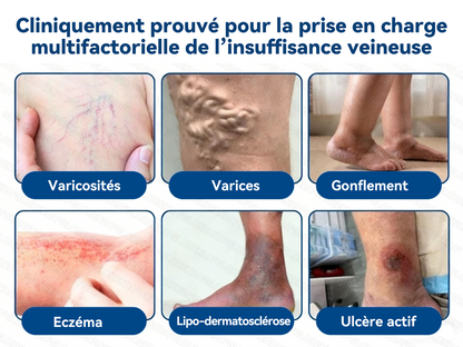 𝐆𝑳𝑶𝗥𝙀𝙉𝐃𝑨®𝐏𝐚𝒕𝒄𝗵 𝗠𝙞𝙘𝙧𝙤𝙣𝙚𝐞𝐝𝐥𝒆 𝑪𝒐𝒏𝘁𝗼𝙪𝙧 𝙙𝐞𝐬 𝐕𝐞𝒊𝒏𝒆𝘀 𝗮𝘃𝙚𝙘 𝙇𝙞𝙫𝐫𝐚𝐢𝐬𝒐𝒏 𝑨𝒗𝒂𝗻𝗰é𝙚 𝙙𝙚 𝘿𝙞𝐨𝐬𝐦𝐢𝒏𝒆 & 𝑯𝗲𝘀𝗽é𝗿𝙞𝙙𝙞𝙣𝙚💃 𝐑é𝐬𝐮𝐥𝐭𝐚𝐭𝐬 𝐕𝐢𝐬𝐢𝐛𝐥𝐞𝐬 𝐞𝐧 𝟕 𝐉𝐨𝐮𝐫𝐬 — 𝐌é𝐥𝐚𝐧𝐠𝐞 𝐇𝐞𝐫𝐛𝐨𝐫𝐢𝐬𝐭𝐞 𝐀𝐯𝐚𝐧𝐜é 𝐂𝐢𝐛𝐥𝐞 𝐥𝐞𝐬 𝐕𝐞𝐢𝐧𝐞𝐬 𝐓é𝐥𝐚𝐧𝐠𝐢𝐞𝐜𝐭𝐚𝐭𝐢𝐪𝐮𝐞𝐬 𝐞𝐭 𝐒𝐨𝐮𝐥𝐚𝐠𝐞 𝐥𝐞𝐬 𝐉𝐚𝐦𝐛𝐞𝐬 𝐋𝐨𝐮𝐫𝐝𝐞𝐬 𝐞𝐭 𝐅𝐚𝐭𝐢𝐠𝐮é𝐞𝐬